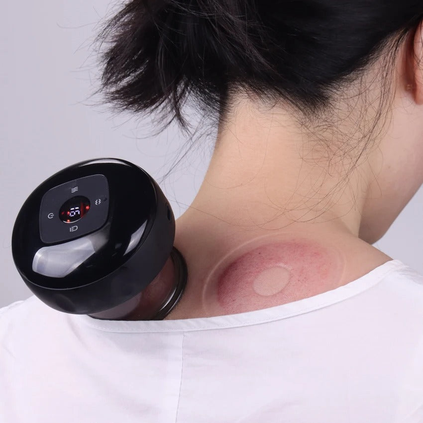 CuppingLife: Compact Cupping Therapy